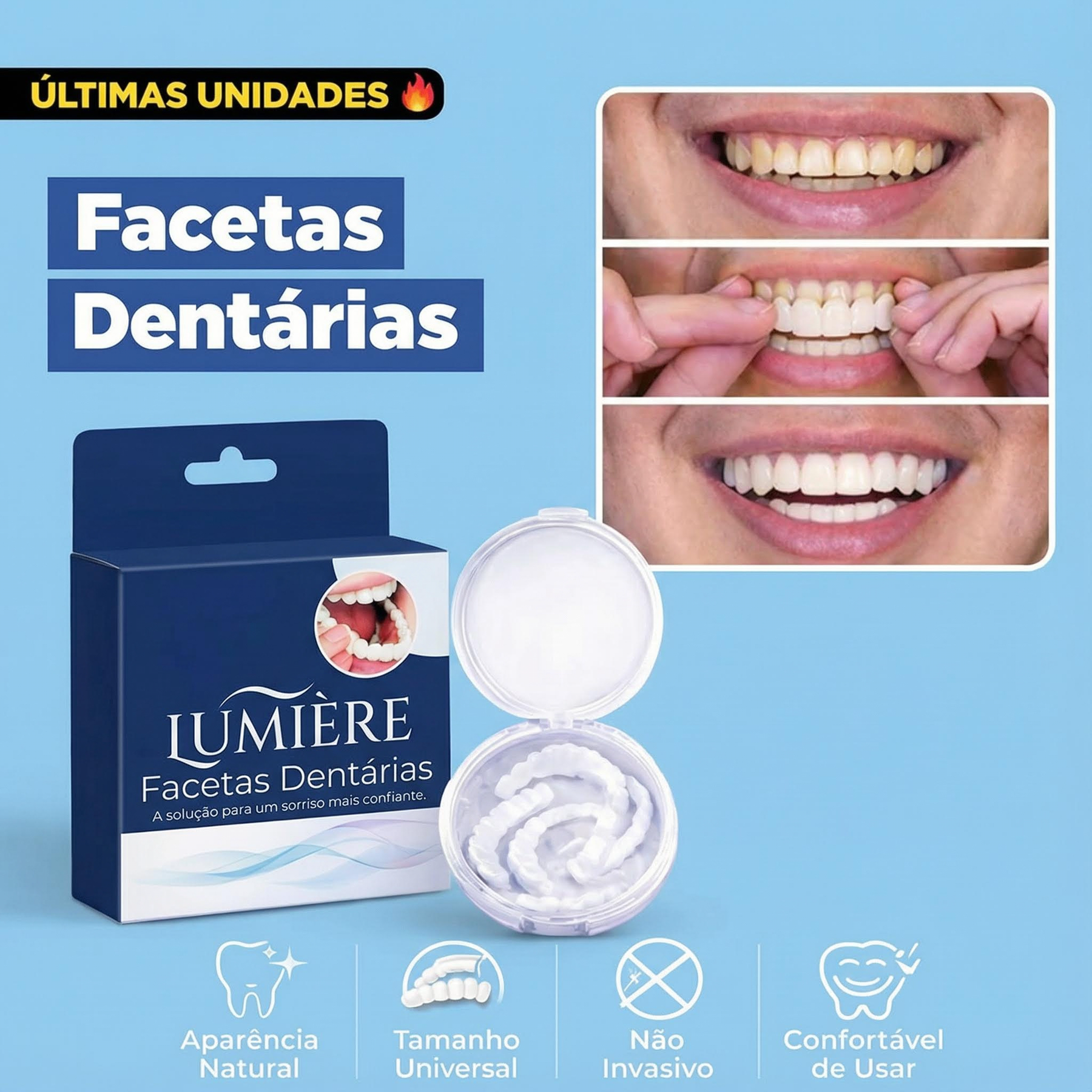 Lumiere White — Facetas Removíveis Premium